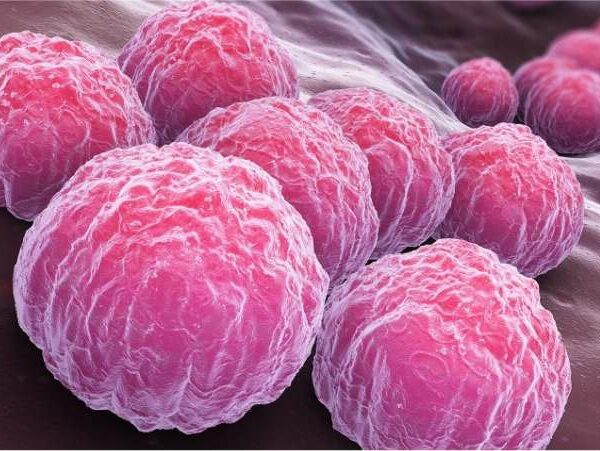 Clamidia causa infertilidade - Dra Mila Cerqueira - ginecologista Florianópolis