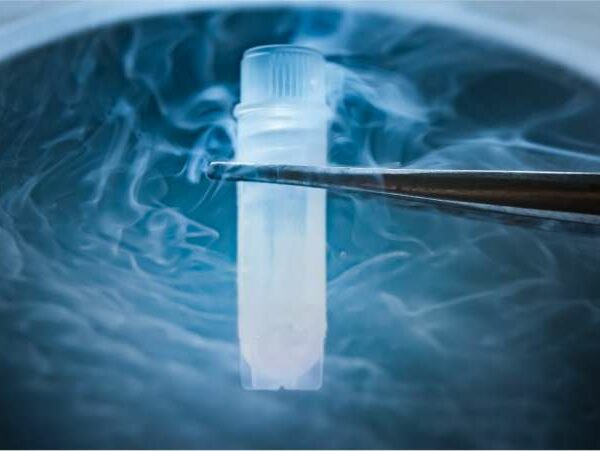 Congelamento de ovulos - Dra Mila Cerqueira - ginecologista Florianópolis