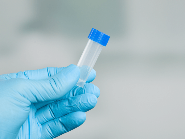 espermograma - dra Mila Cerqueira Ginecologista Florianopolis