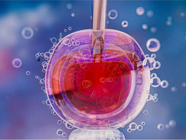 fertilização in vitro - Dra Mila Cerqueira - Ginecologista Florianópolis