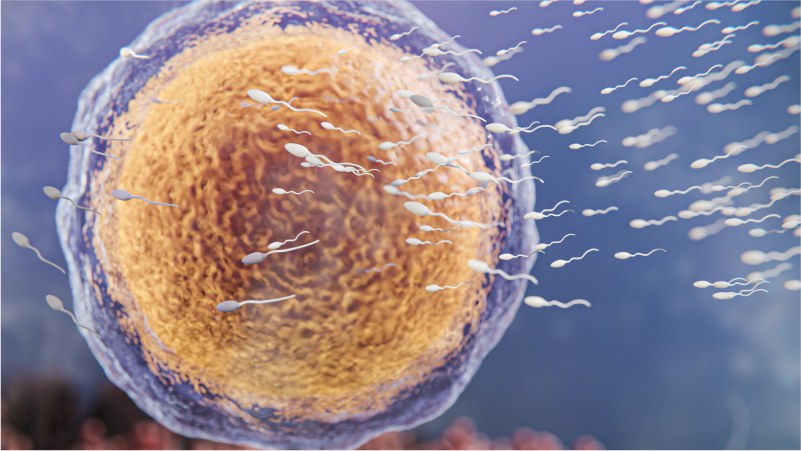 A fertilização in vitro irá funcionar se você tiver endometriose? - Dra Mila Cerqueira - ginecologista florianópolis